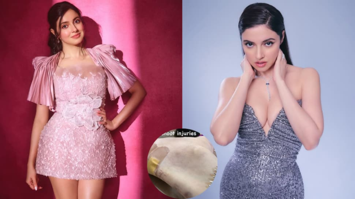 Divya Khosla is hurt on the film set, Neetzance wishes her a quick recovery

