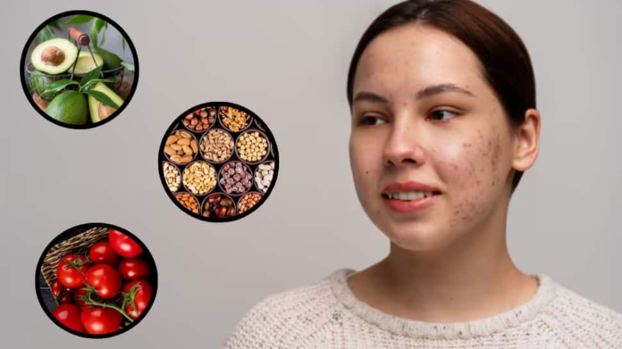 7 Nutrient -rich foods that help naturally control sebum levels and prevent acne


