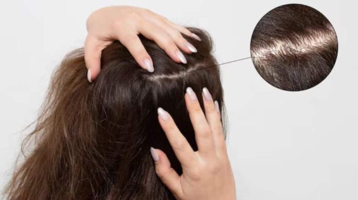 Your skull also requires skincare: hair that changes hair

