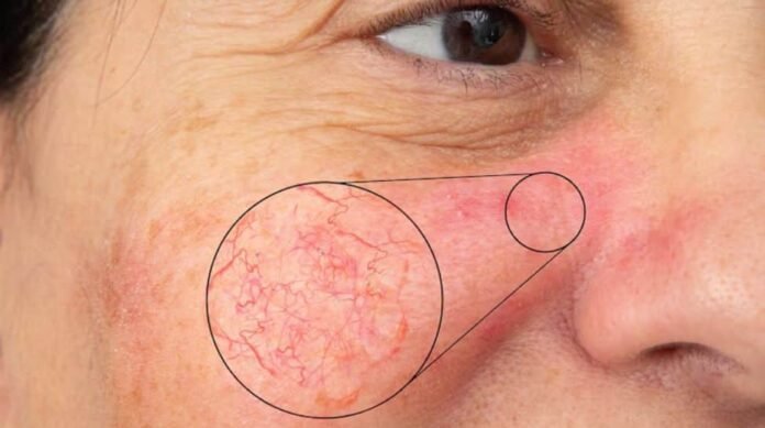 How is climate change quietly damaging your skin?

