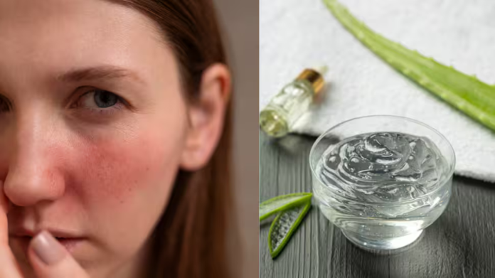 Aloe vera side effects on the skin: risks, allergic reactions, irritation, and who should avoid using it

