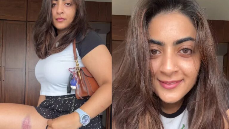 Aamir Khan's niece Zayn Marie shares video of injury marks after being detained during CJP protest in Mumbai