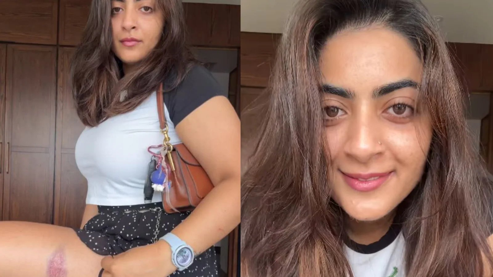 Aamir Khan's niece Zayn Marie shares video of injury marks after being detained during CJP protest in Mumbai